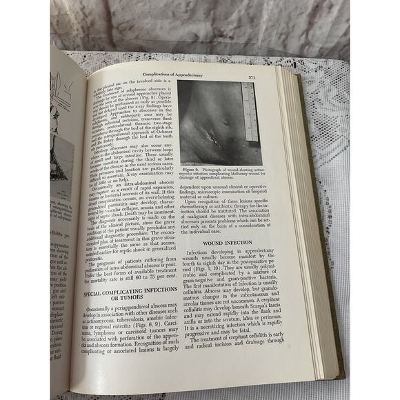 1967 Complications In Surgery And Their Management - Picture 9 of 9
